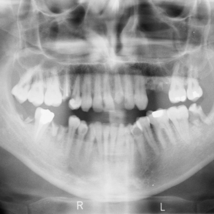 Diagnóstico Dental Digitalizado.